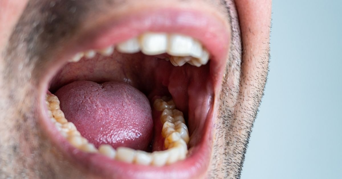 exercicios para parar de roncar